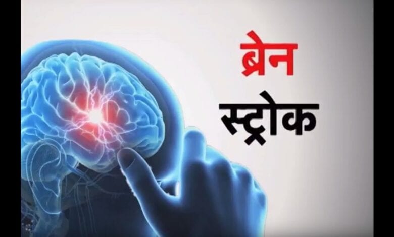 Brain-Strok-Amravati-Mandal