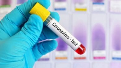 Covid-test-amravati-mandal