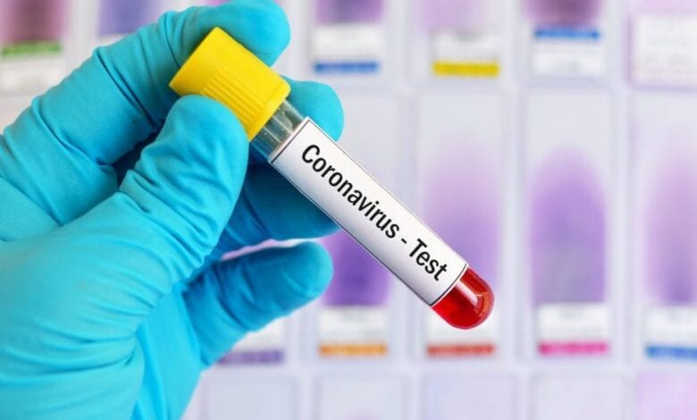 Covid-test-amravati-mandal