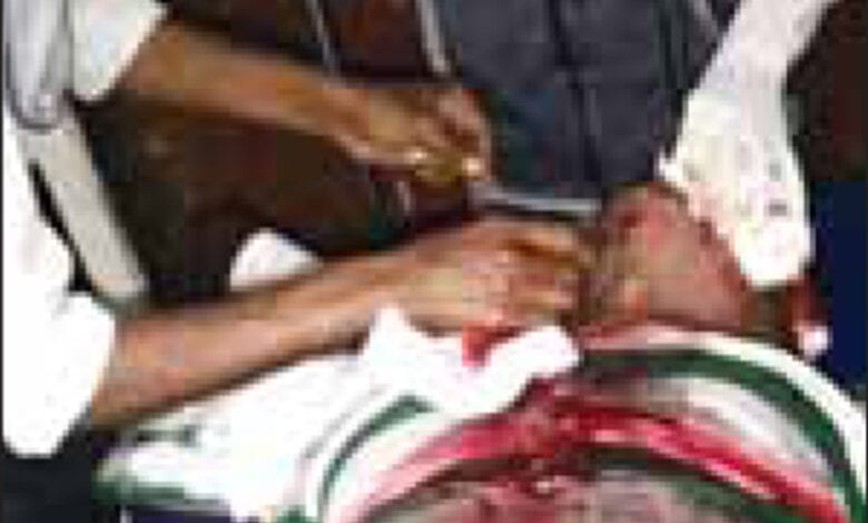 Coyote-attack-amravati-mandal