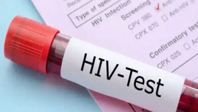 HIV-test-amravati-mandal