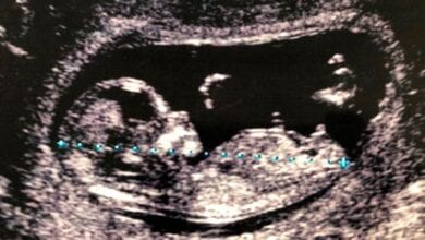 Unborn-Baby-Amravati-Mandal
