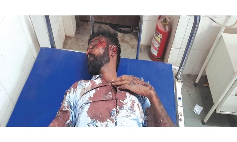accident-amravati-mandal