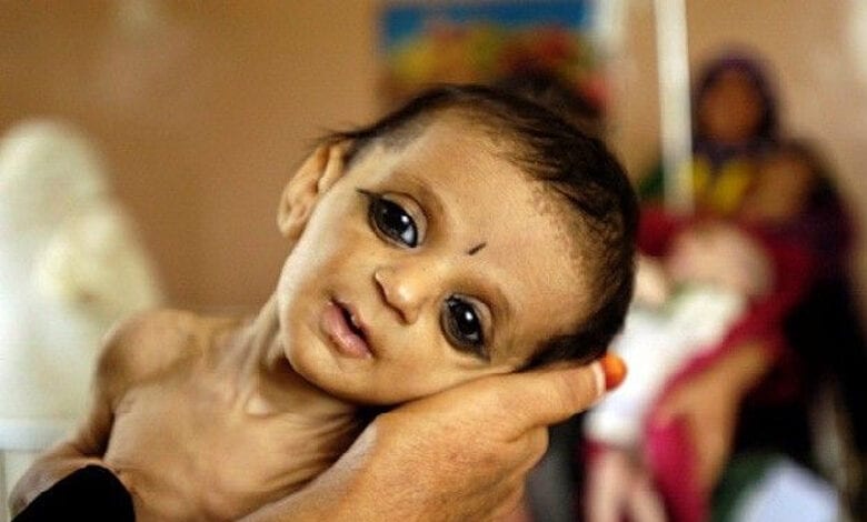 malnourished-amravati-mandal