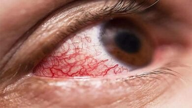 mucor-mycosis-amravati-mandal