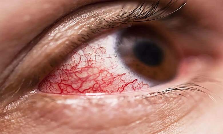 mucor-mycosis-amravati-mandal