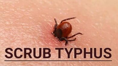 Scrub-typhus-amravati-mandal