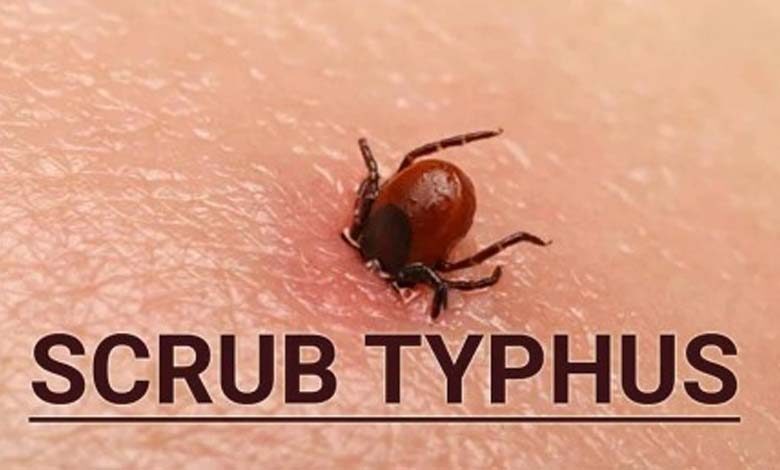 Scrub-typhus-amravati-mandal