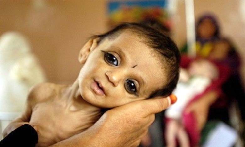 malnutrition-amravati-mandal