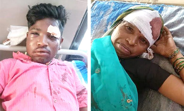 Injured-amravati-mandal