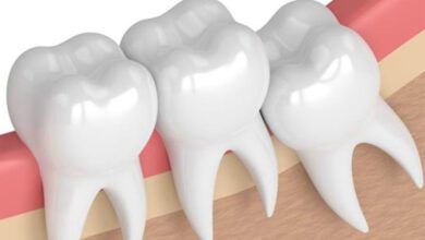 teeth-amravati-mandal