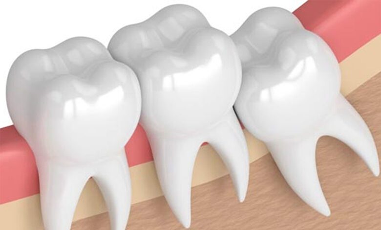 teeth-amravati-mandal